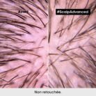 SCALPADVANCEDSHAMPOOINGPROFESSIONNELPOURCUIRCHEVELUSENSIBLE_5.jpg