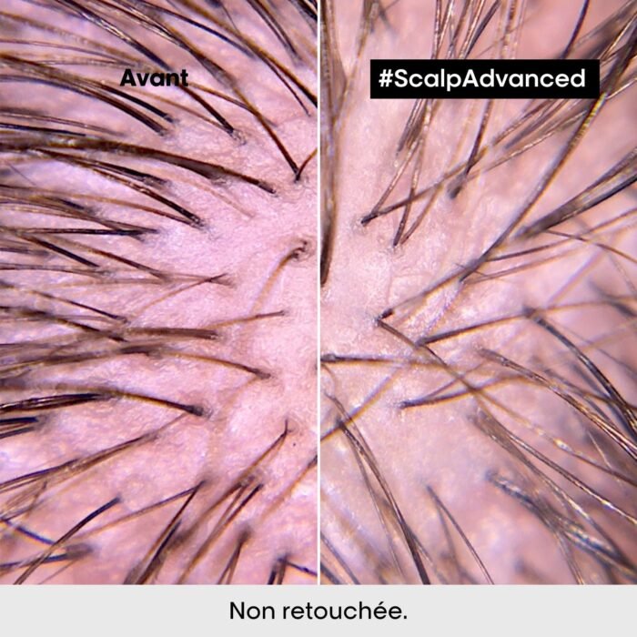 SCALPADVANCEDSHAMPOOINGPROFESSIONNELPOURCUIRCHEVELUSENSIBLE_5.jpg