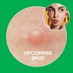 NOLAHOUR Spot Eraser Green Step 1 – Image 2