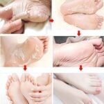 FOOTSTEPS CHAUSSETTES EXFOLIANTES – Image 3
