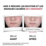 NEUTROGENA ANTI-BOUTONS+ SERUM QUOTIDIEN 30ML – Image 6