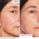 Erborian Skin Therapy - Huile visage multi-perfectrice 30ml – Image 2