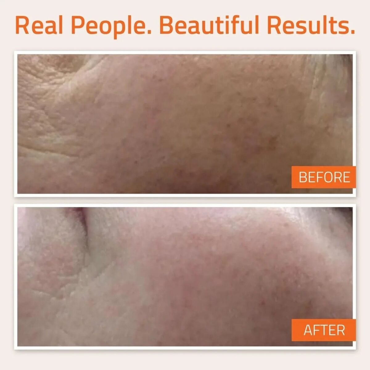 YEOUTH Vitamin C & E Serum 30 ML – Image 3