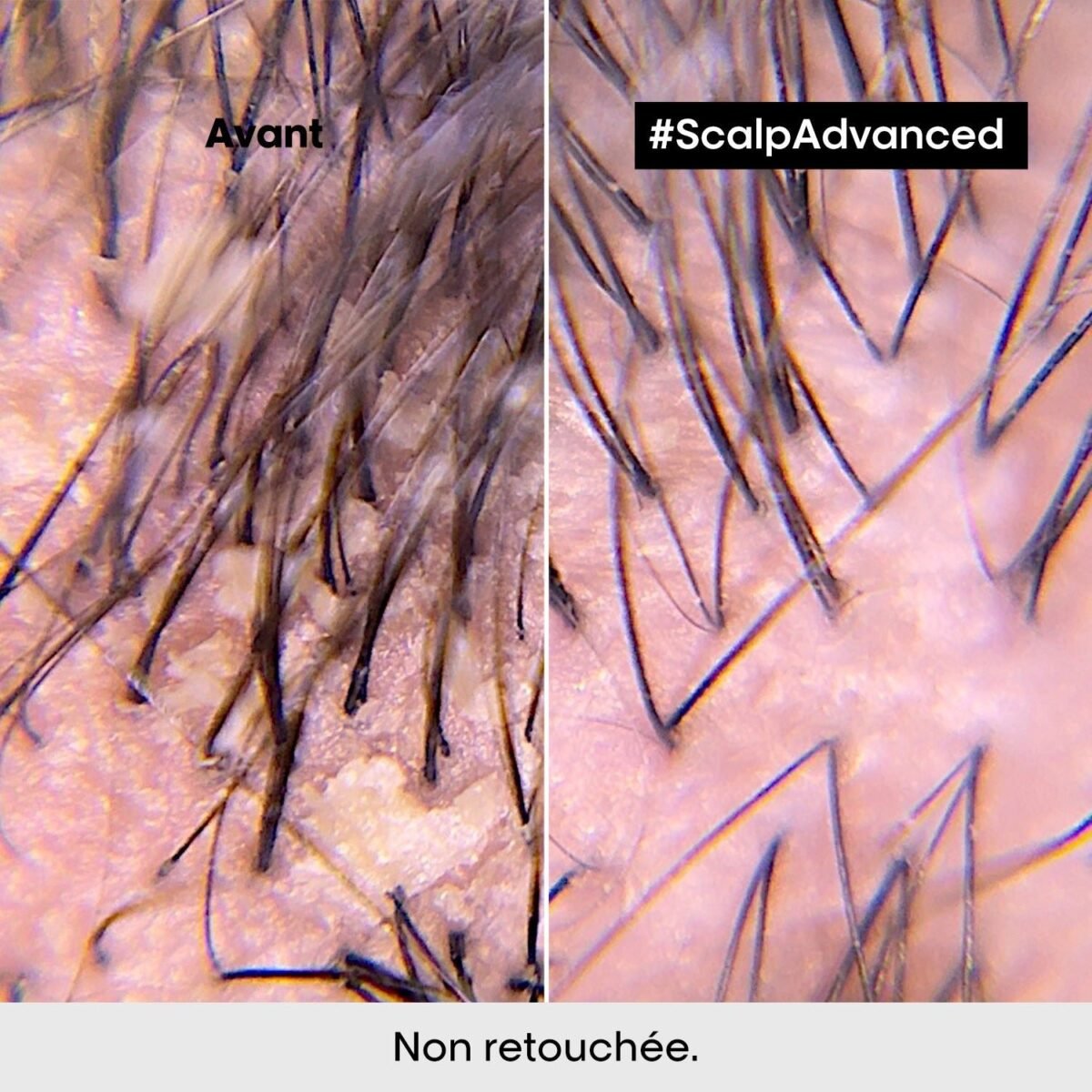 L'Oréal Professionnel scalp advanced shampooing dermo clarifiant 300ML – Image 4