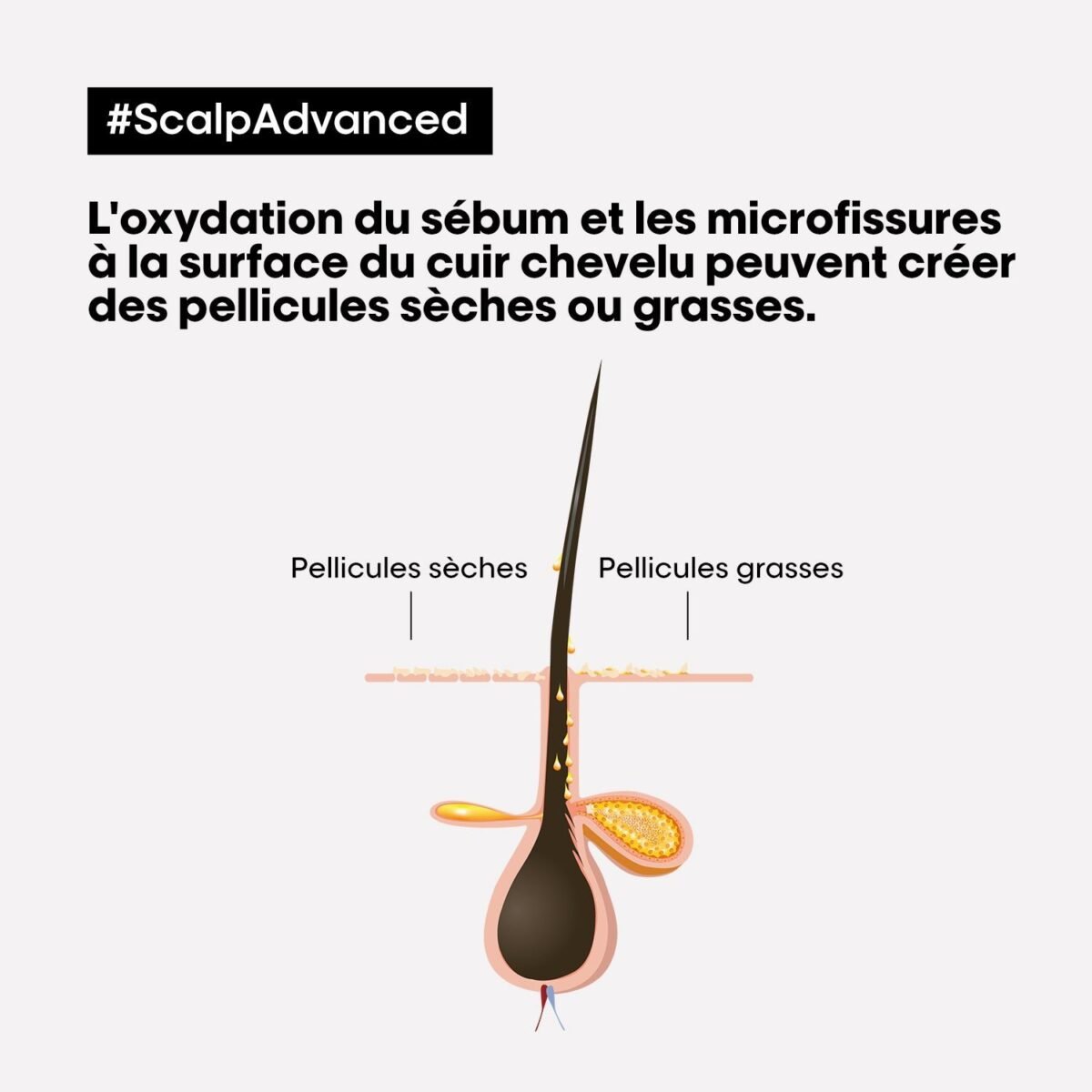 L'Oréal Professionnel scalp advanced shampooing dermo clarifiant 300ML – Image 6