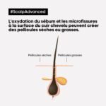 L'Oréal Professionnel scalp advanced shampooing dermo clarifiant 300ML – Image 6