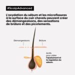 L'Oréal Professionnel scalp advanced shampooing dermo regulateur 300 ml – Image 5