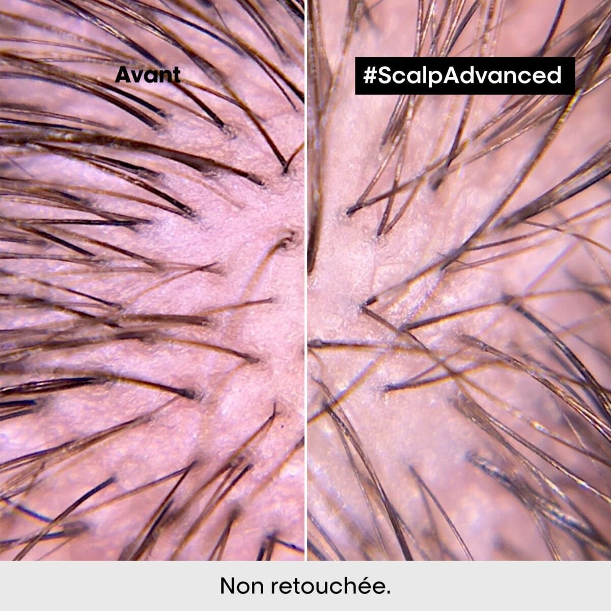 L'Oréal Professionnel scalp advanced shampooing dermo regulateur 300 ml – Image 6