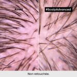 L'Oréal Professionnel scalp advanced shampooing dermo regulateur 300 ml – Image 6