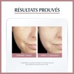 Eucerin ANTI-PIGMENT SÉRUM DUO 50 ML + Ecran pigment spf50 OFFERT – Image 4