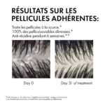 Vichy Dercos Shampoing Traitant Anti-Pelliculaire Cheveux Secs | 200ml – Image 11