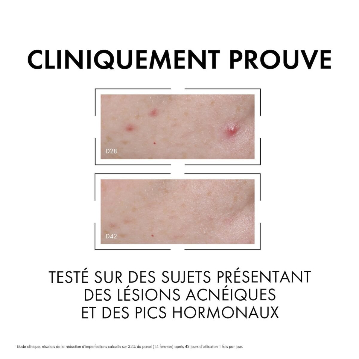Vichy Normaderm Sérum Anti-imperfections PROBIO-BHA. Peau Grasse Acnéique | 30ml – Image 7