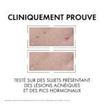 Vichy Normaderm Sérum Anti-imperfections PROBIO-BHA. Peau Grasse Acnéique | 30ml – Image 7